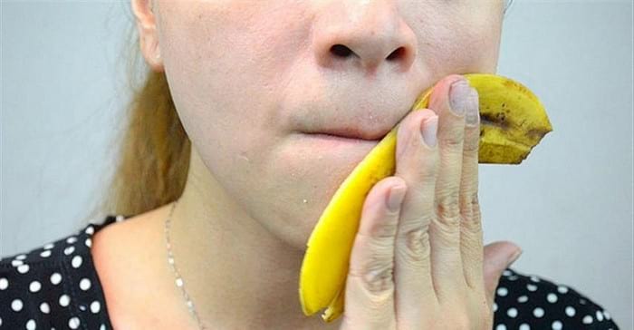 Bananų žievelės – puikus būdas turėti sveiką veido odą