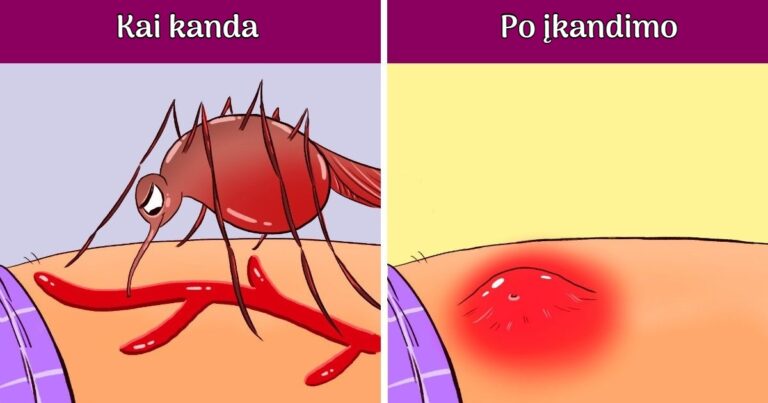 Kas nutinka žmogaus organizmui, kai įkanda uodas?