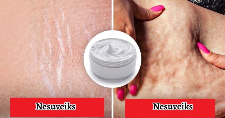 Dermatologai rekomenduoja: neleiskite pinigų šiems grožio produktams