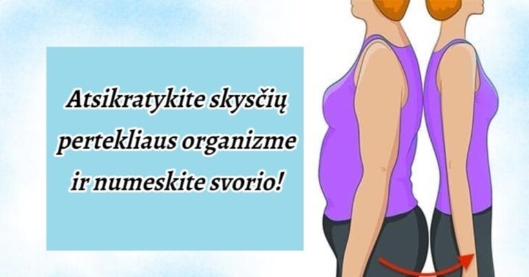 Kaip atsikratyti skysčių pertekliaus organizme: tai gali būti antsvorio priežastis!