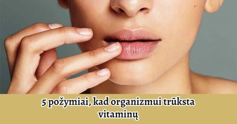 5 požymiai, kad jūsų organizmui trūksta vitaminų