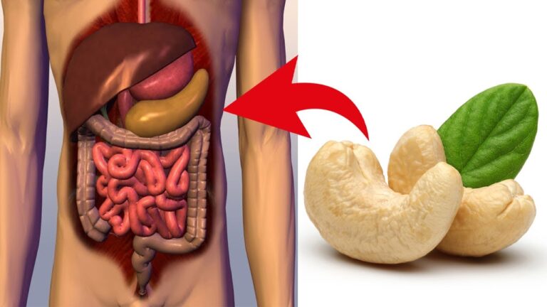 Kas nutiks jūsų organizmui, jei kasdien valgysite anakardžių riešutų?